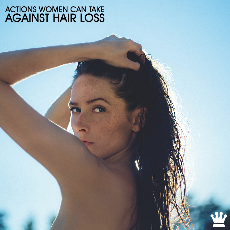 4773fb456434bf2cc663 hair loss prevention