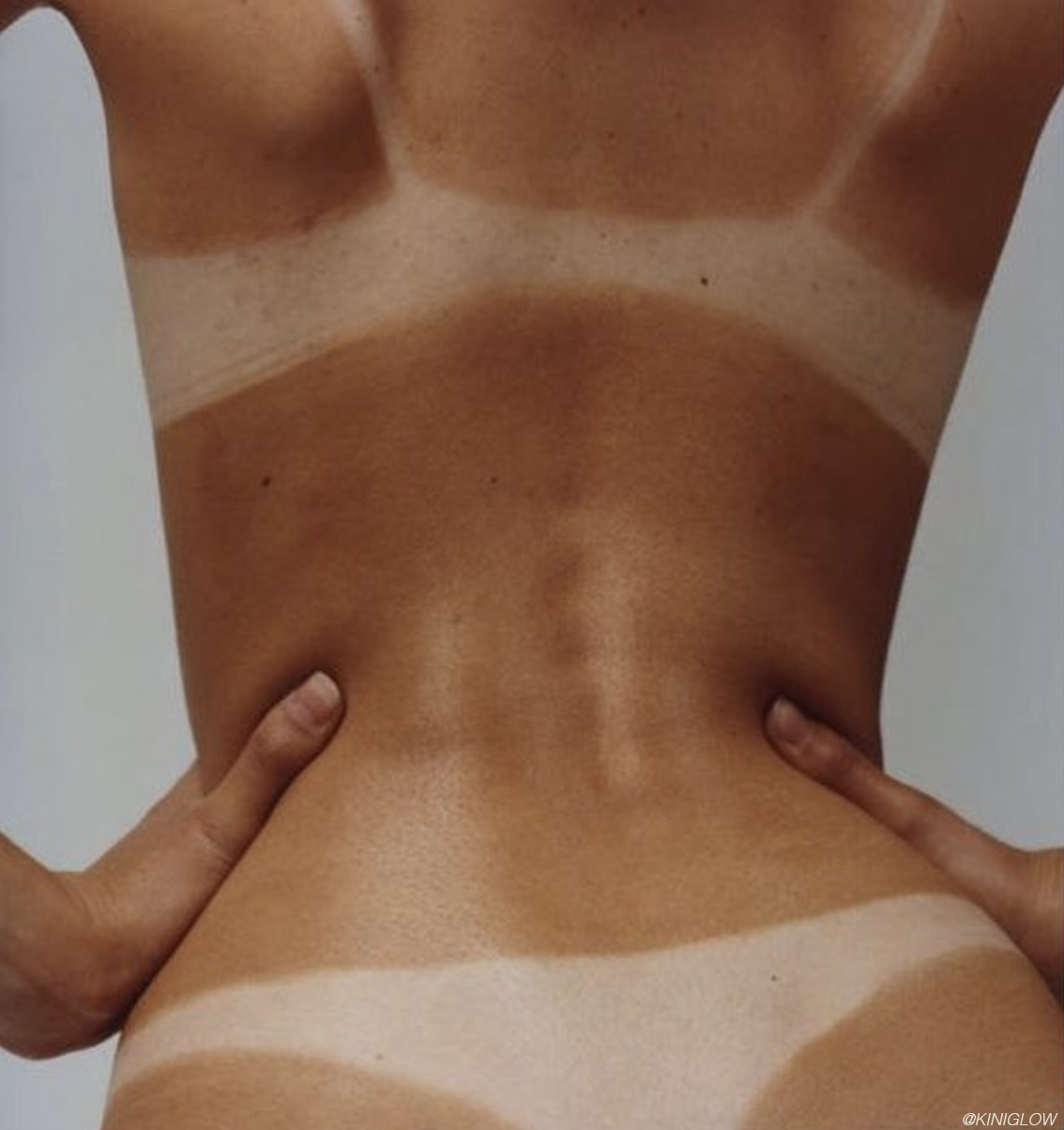 66d2f55515f3c1281cb8 after sun care