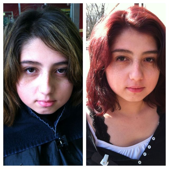 before and after