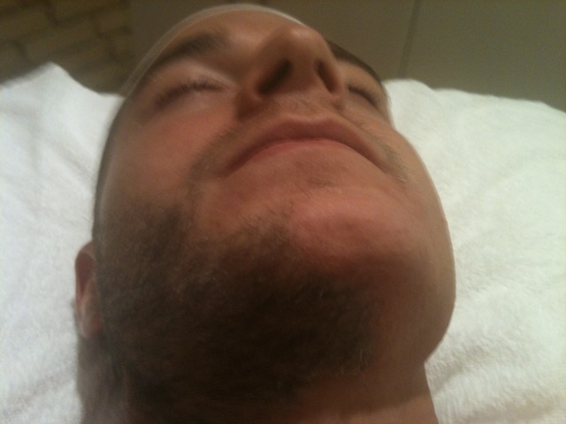 hair removal of a beard