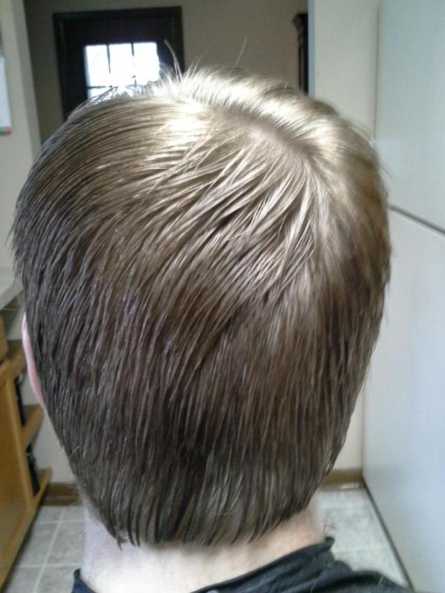 the back of Bryson's cut